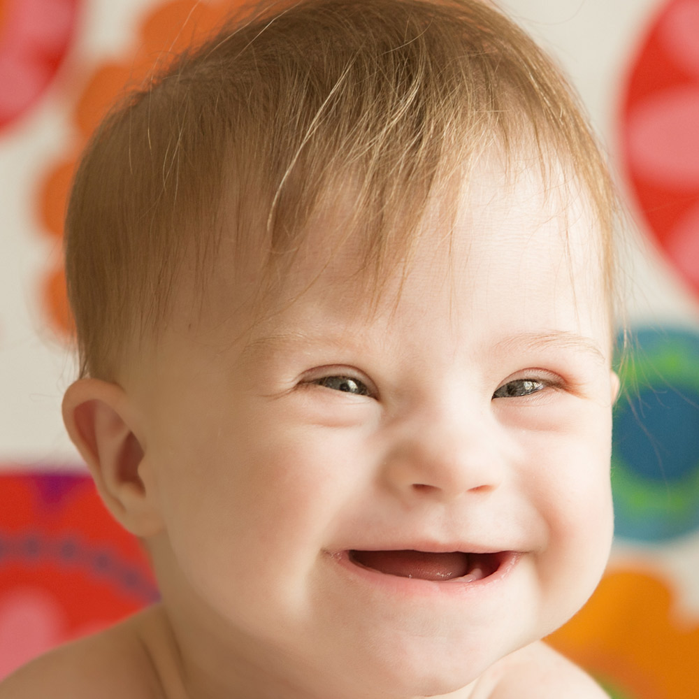 Issue 28 Looking Out for Our Eyes Down Syndrome Amongst Us